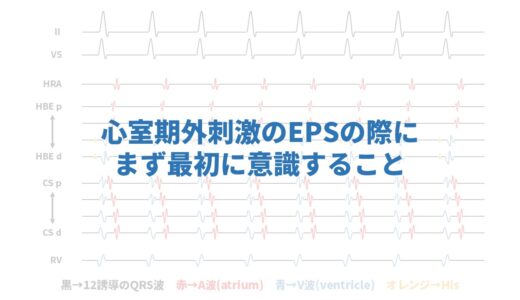 心室期外刺激のEPSの際にまず最初に意識すること