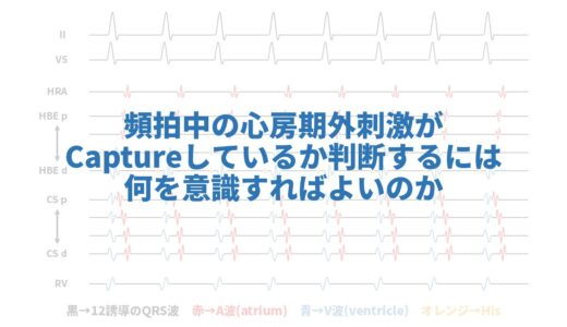 頻拍中に心房期外刺激のpacingがcaptureしているかどうか判断するには何を意識すればよいのか